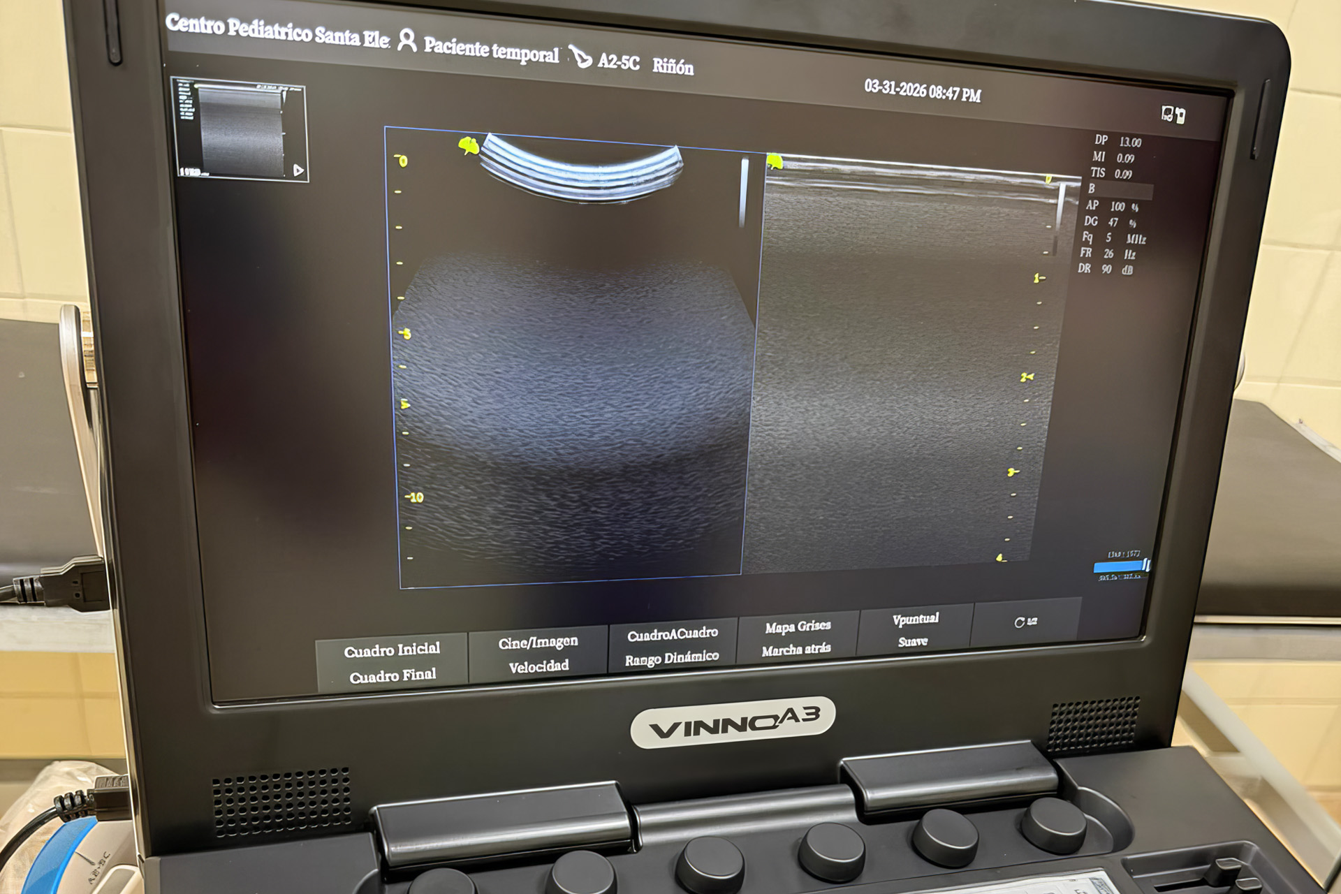 Imagen de noticia El Hospital Centenario suma un nuevo ecógrafo en una inversión de casi 80 millones