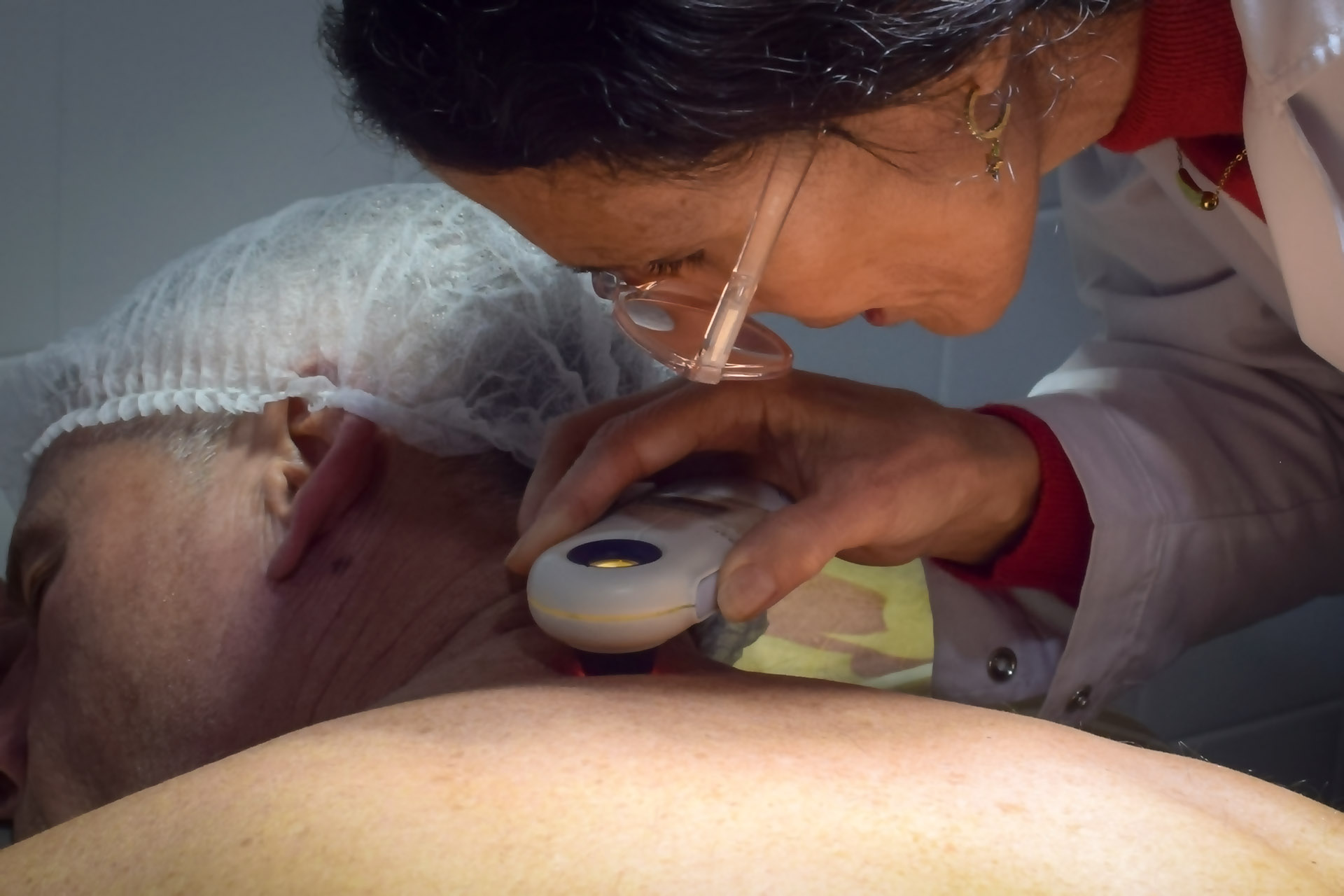 Imagen de noticia Salud promueve la consulta temprana de revisión de lesiones para prevenir el cáncer de piel