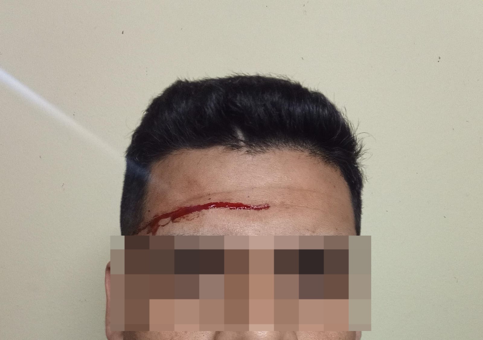 Imagen de noticia Un hombre fue aprehendido tras agredir con un destornillador a un efectivo durante una notificación judicial
